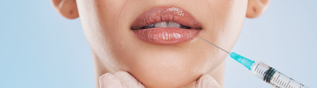 5 Things to Consider Before Getting Lip Fillers